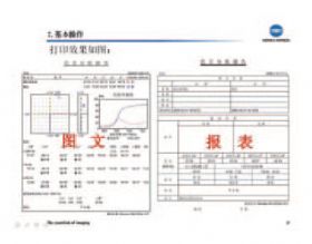 图文报表
